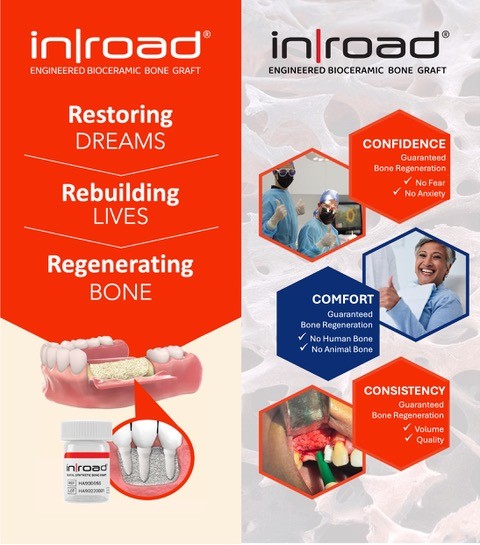 Discover the benefits of InRoad