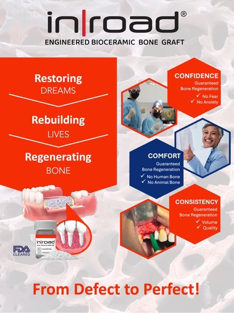 Discover the benefits of InRoad